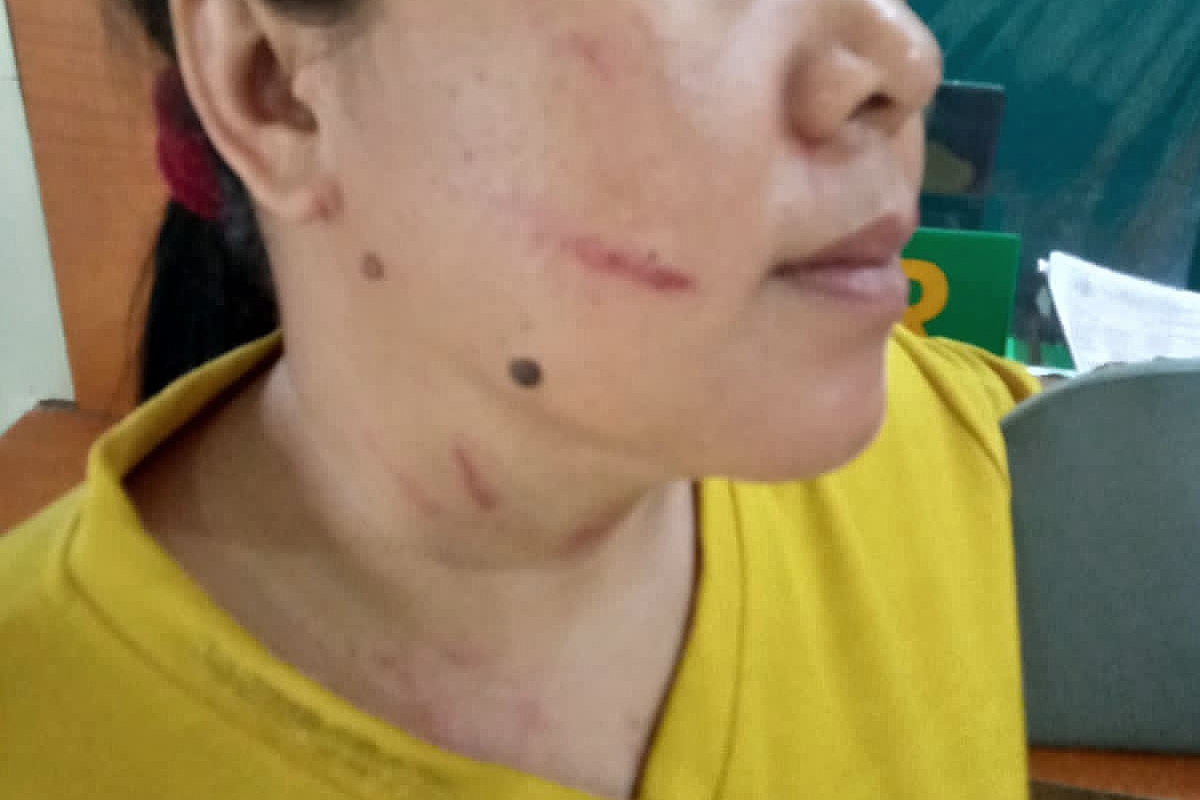 Seorang wanita dianiaya oleh kekasih gelap suami